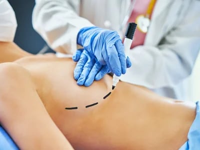 Nach der Brustverkleinerung: Was Sie über den Heilungsprozess wissen sollten