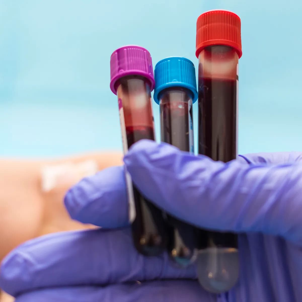 Zukunft der Labormedizin: Mehr Qualität durch Präanalytik