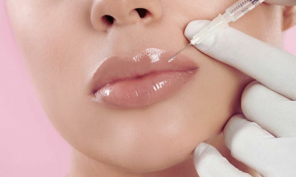 MY AESTHETICS in Nürnberg: Hyaluron Nürnberg für eine frische, strahlende Haut